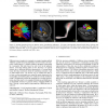 Visualization of White Matter Tracts with Wrapped Streamlines
