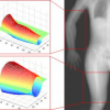 Volumetric reconstruction from multi-energy single-view radiography